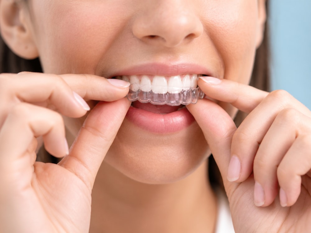 Patient fitting a clear aligner tray